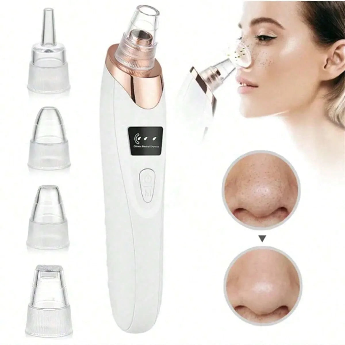 2026 Facial Pore Cleaner, 5 Suction Power Blackhead Remover Pore Vacuum - USB Rechargeable Facial Pore Cleaner Kit